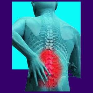 muscle spasm of back pain