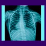 Back Pain When Breathing - Back Pain