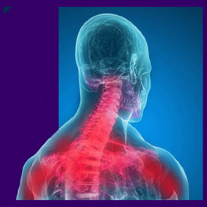 Neck and Upper Back Pain