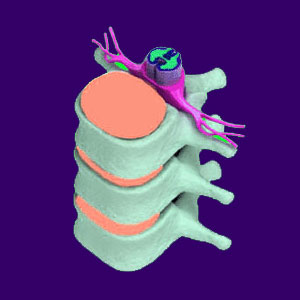 Nerve Roots - Back Pain