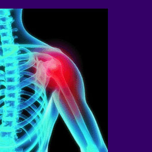 Shoulder Bursitis - Back Pain