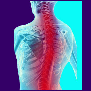 Spinal Stenosis Chiropractor - Back Pain