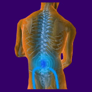 Spinal Stenosis Pain - Back Pain