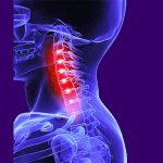 Straight Neck - Back Pain